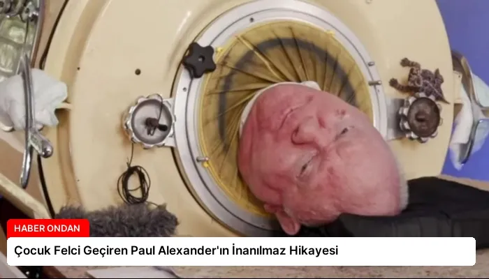Çocuk Felci Geçiren Paul Alexander’ın İnanılmaz Hikayesi