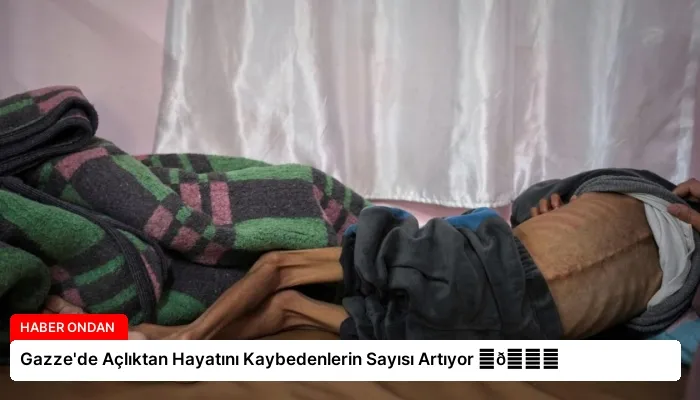Gazze’de Açlıktan Hayatını Kaybedenlerin Sayısı Artıyor ⏬👇