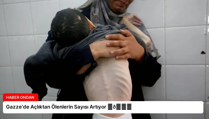 Gazze’de Açlıktan Ölenlerin Sayısı Artıyor ⏬👇
