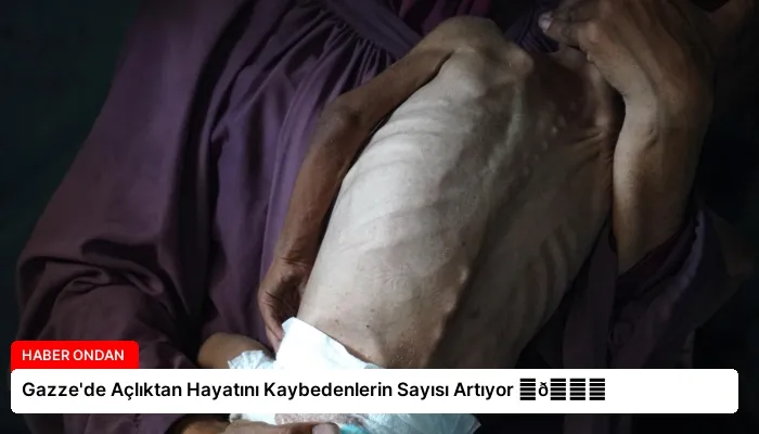 Gazze’de Açlıktan Hayatını Kaybedenlerin Sayısı Artıyor ⏬👇