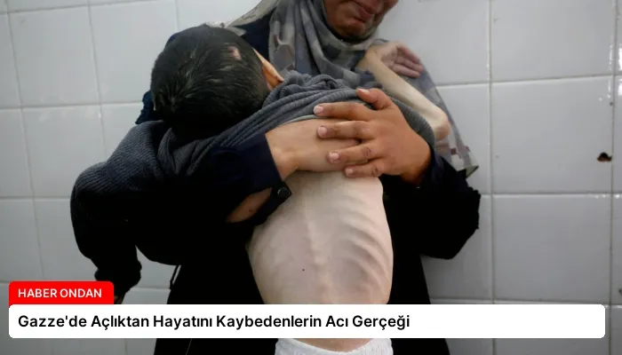 Gazze’de Açlıktan Hayatını Kaybedenlerin Acı Gerçeği
