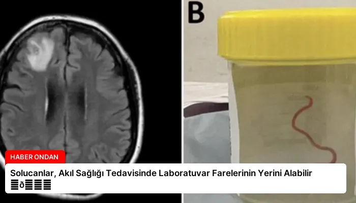 Solucanlar, Akıl Sağlığı Tedavisinde Laboratuvar Farelerinin Yerini Alabilir ⏬👇