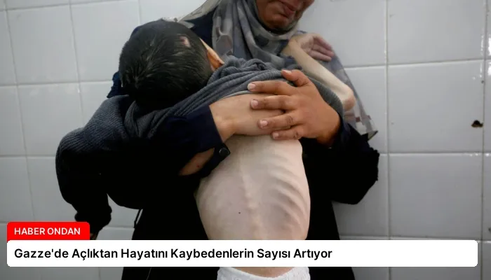 Gazze’de Açlıktan Hayatını Kaybedenlerin Sayısı Artıyor