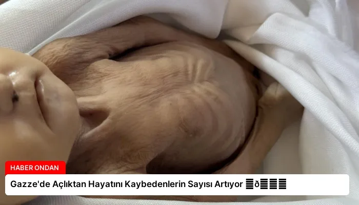 Gazze’de Açlıktan Hayatını Kaybedenlerin Sayısı Artıyor ⏬👇