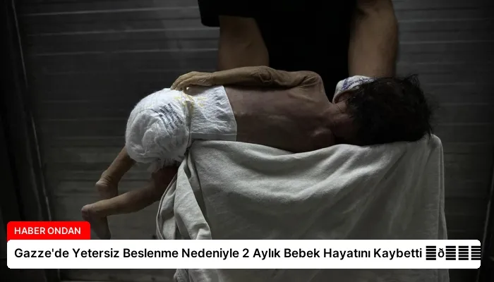 Gazze’de Yetersiz Beslenme Nedeniyle 2 Aylık Bebek Hayatını Kaybetti ⏬👇