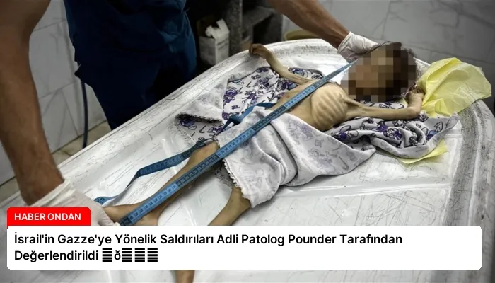 İsrail’in Gazze’ye Yönelik Saldırıları Adli Patolog Pounder Tarafından Değerlendirildi ⏬👇