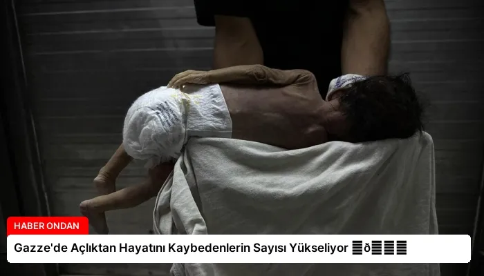 Gazze’de Açlıktan Hayatını Kaybedenlerin Sayısı Yükseliyor ⏬👇