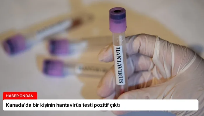 Kanada’da bir kişinin hantavirüs testi pozitif çıktı
