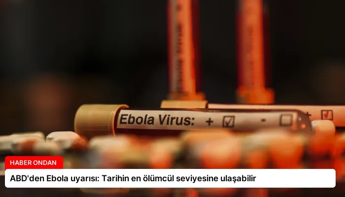 ABD’den Ebola uyarısı: Tarihin en ölümcül seviyesine ulaşabilir