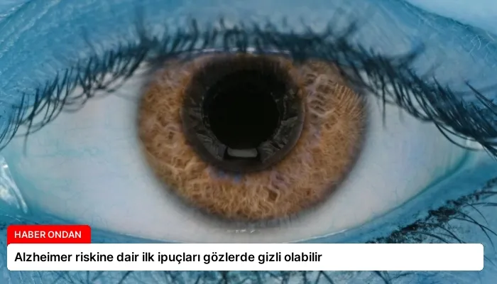 Alzheimer riskine dair ilk ipuçları gözlerde gizli olabilir