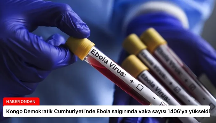 Kongo Demokratik Cumhuriyeti’nde Ebola salgınında vaka sayısı 1406’ya yükseldi